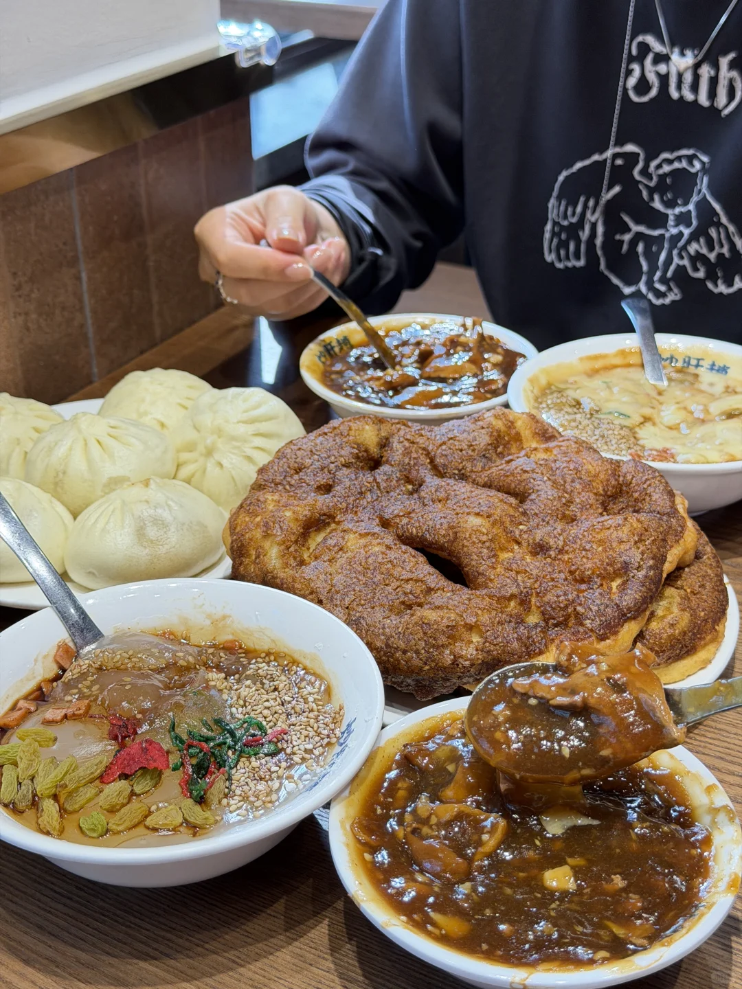 北京MVP结算‼️