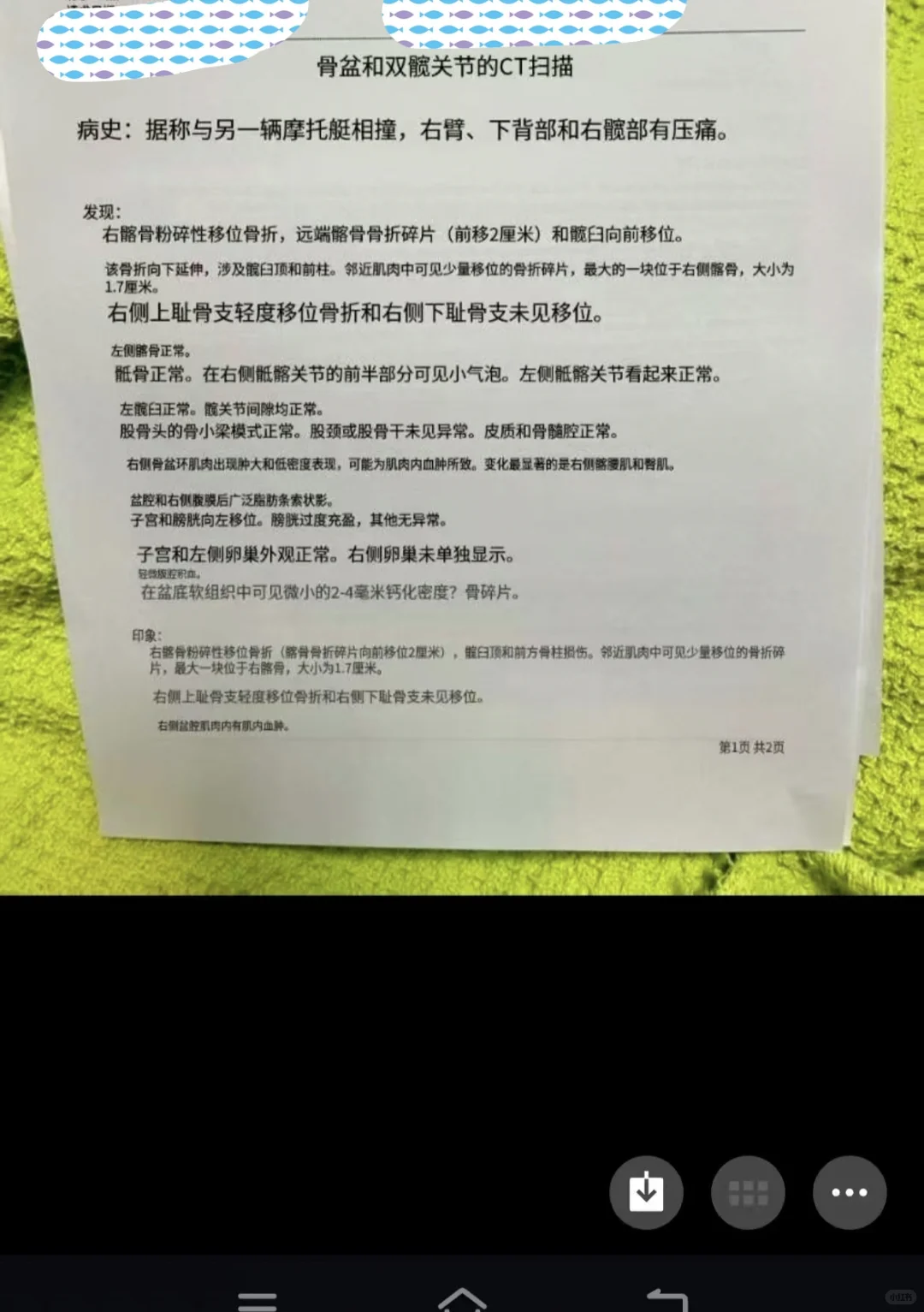 国外受伤，真崩溃😭