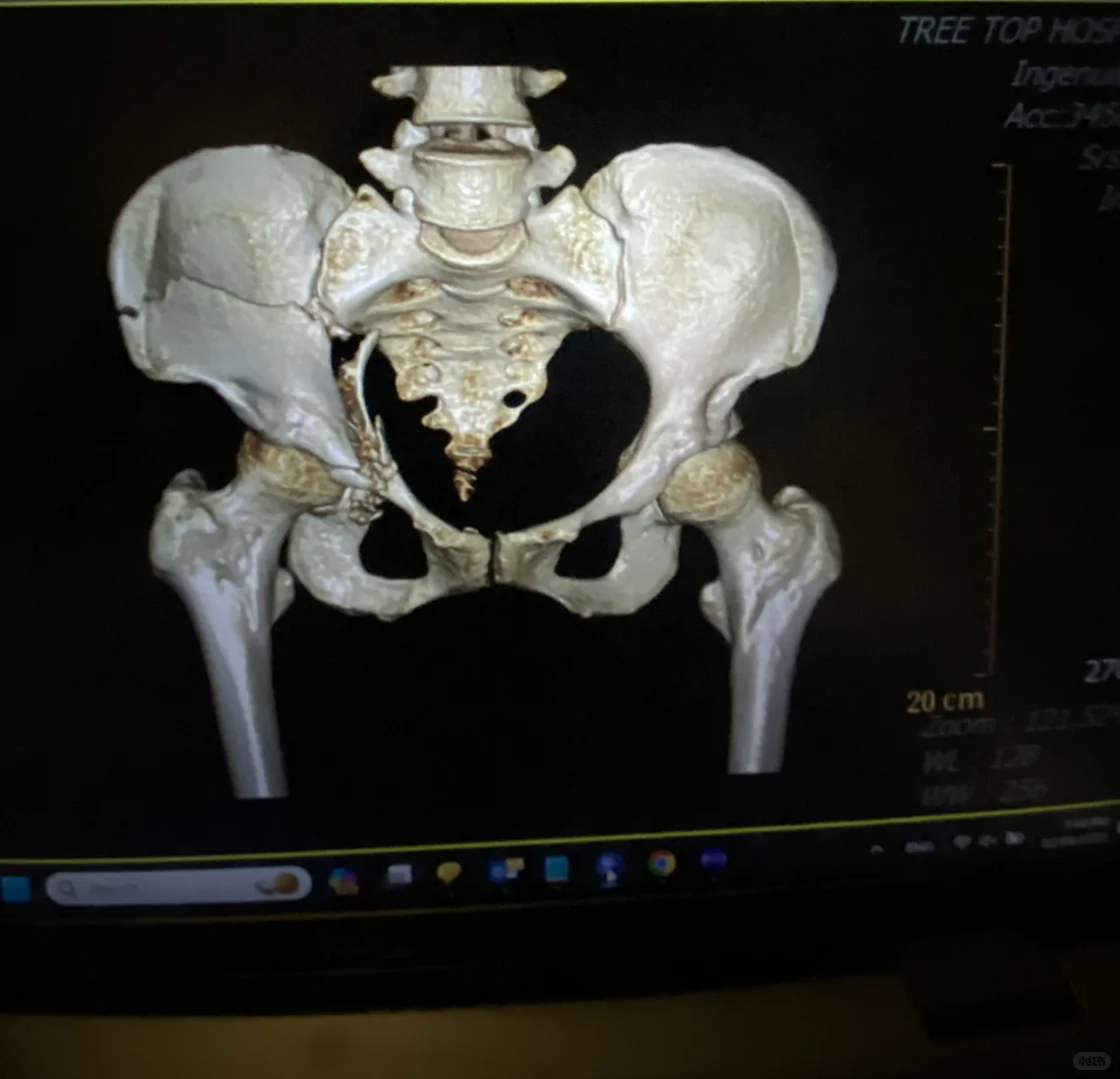 国外受伤，真崩溃😭