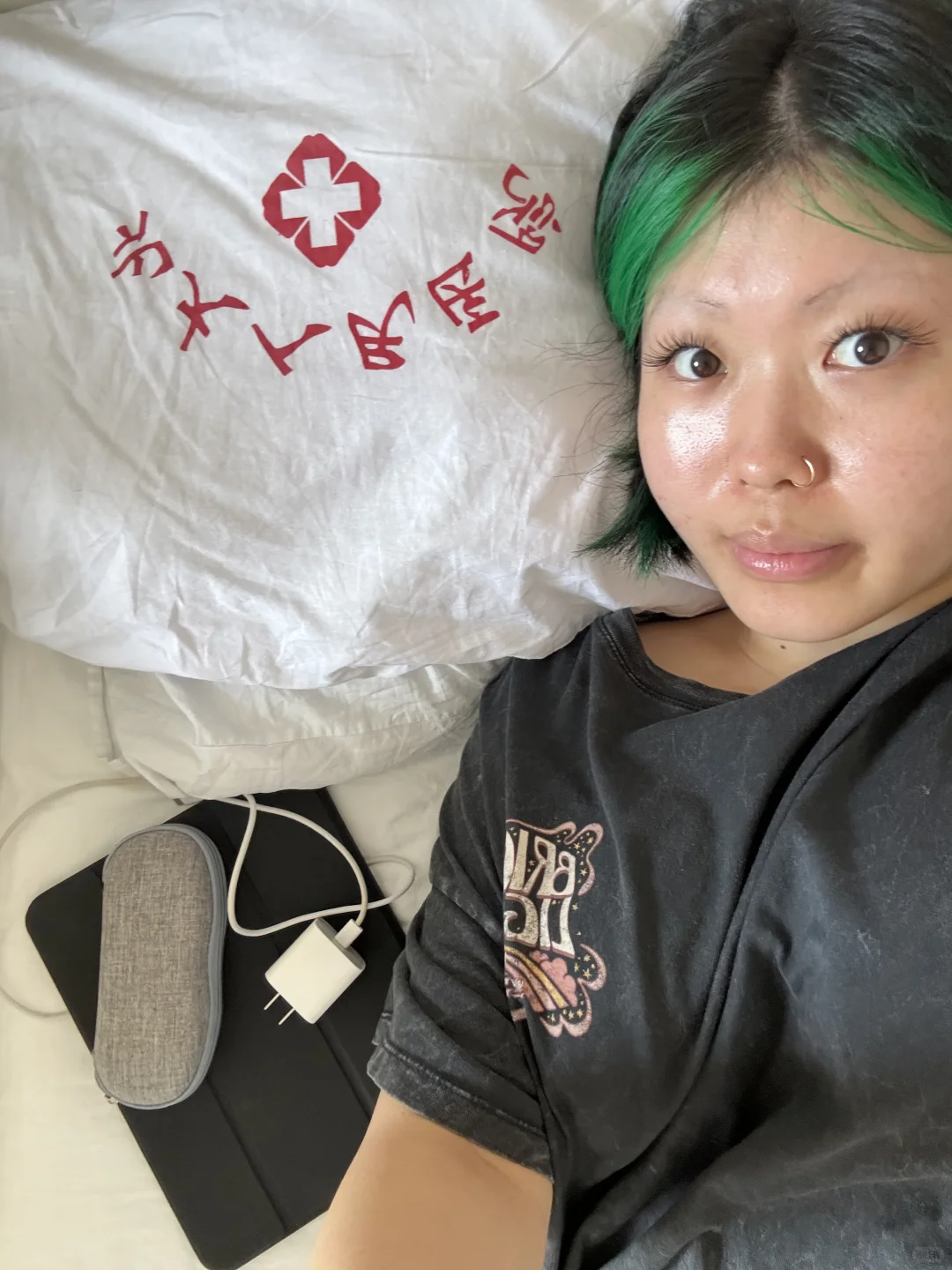 北大人民医院の血管瘤recap