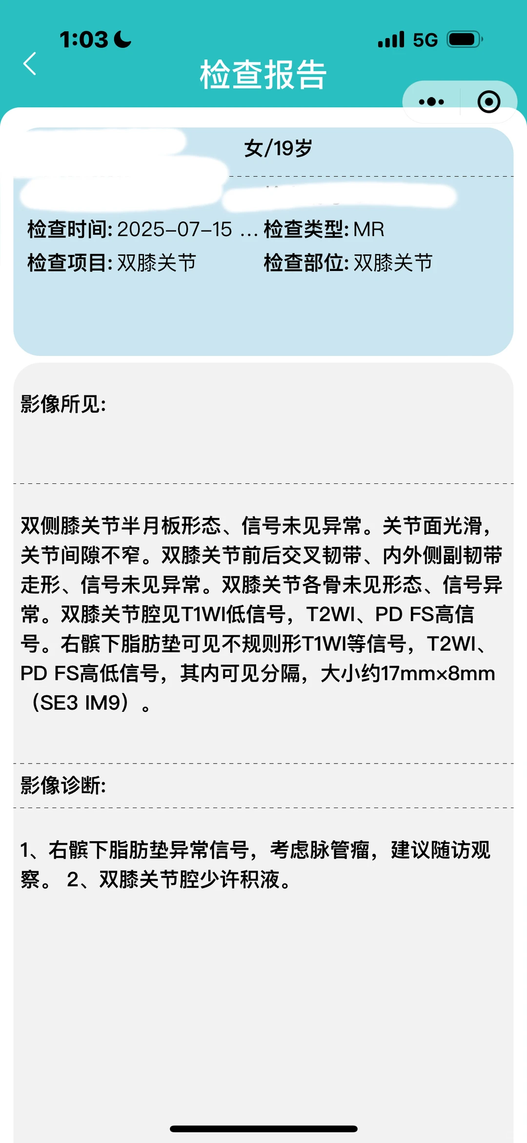 北大人民医院の血管瘤recap