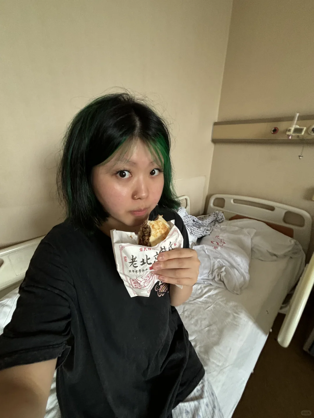 北大人民医院の血管瘤recap