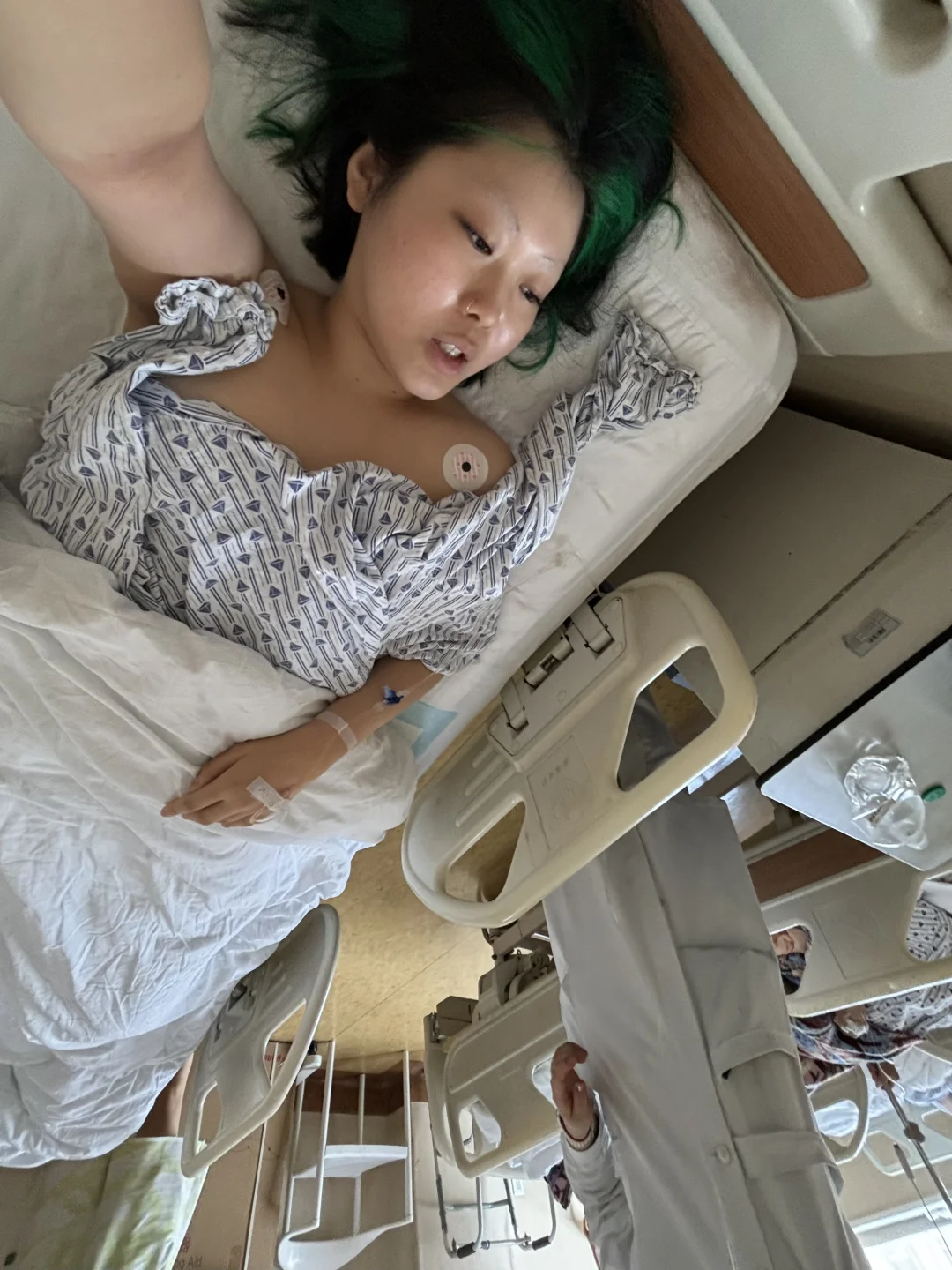 北大人民医院の血管瘤recap