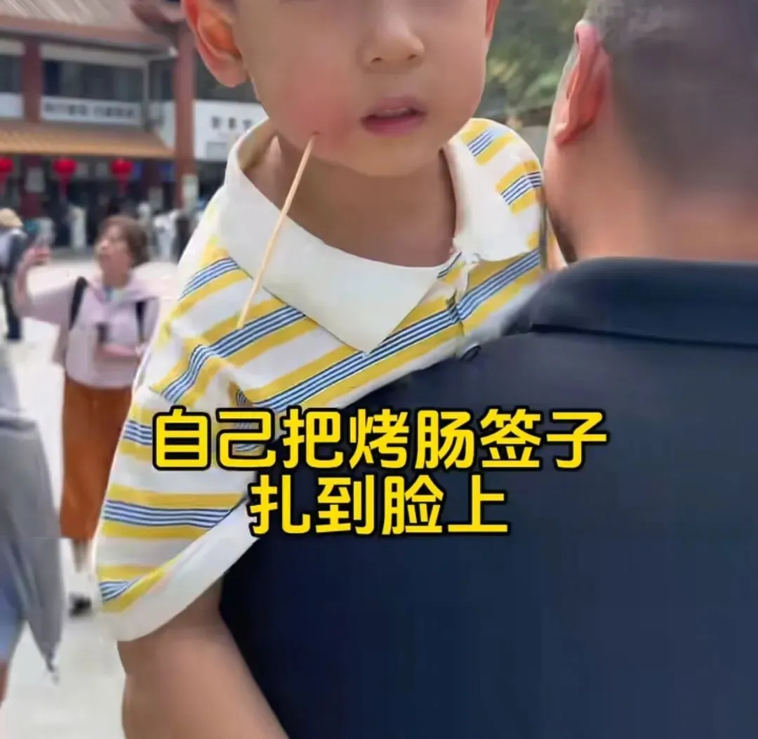 男孩不慎将竹签贯穿脸颊景区工作人员居然……