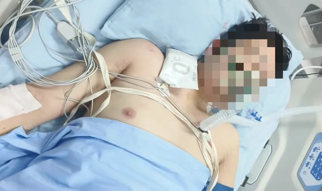 23岁小伙无攻略去西藏旅游,严重高反险丧命!