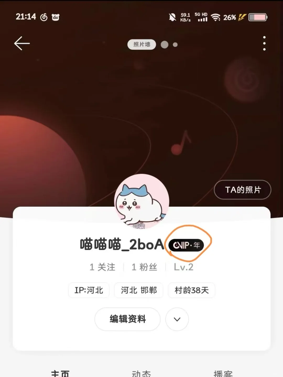 不会还有人没有网易云永久黑胶会员吧！