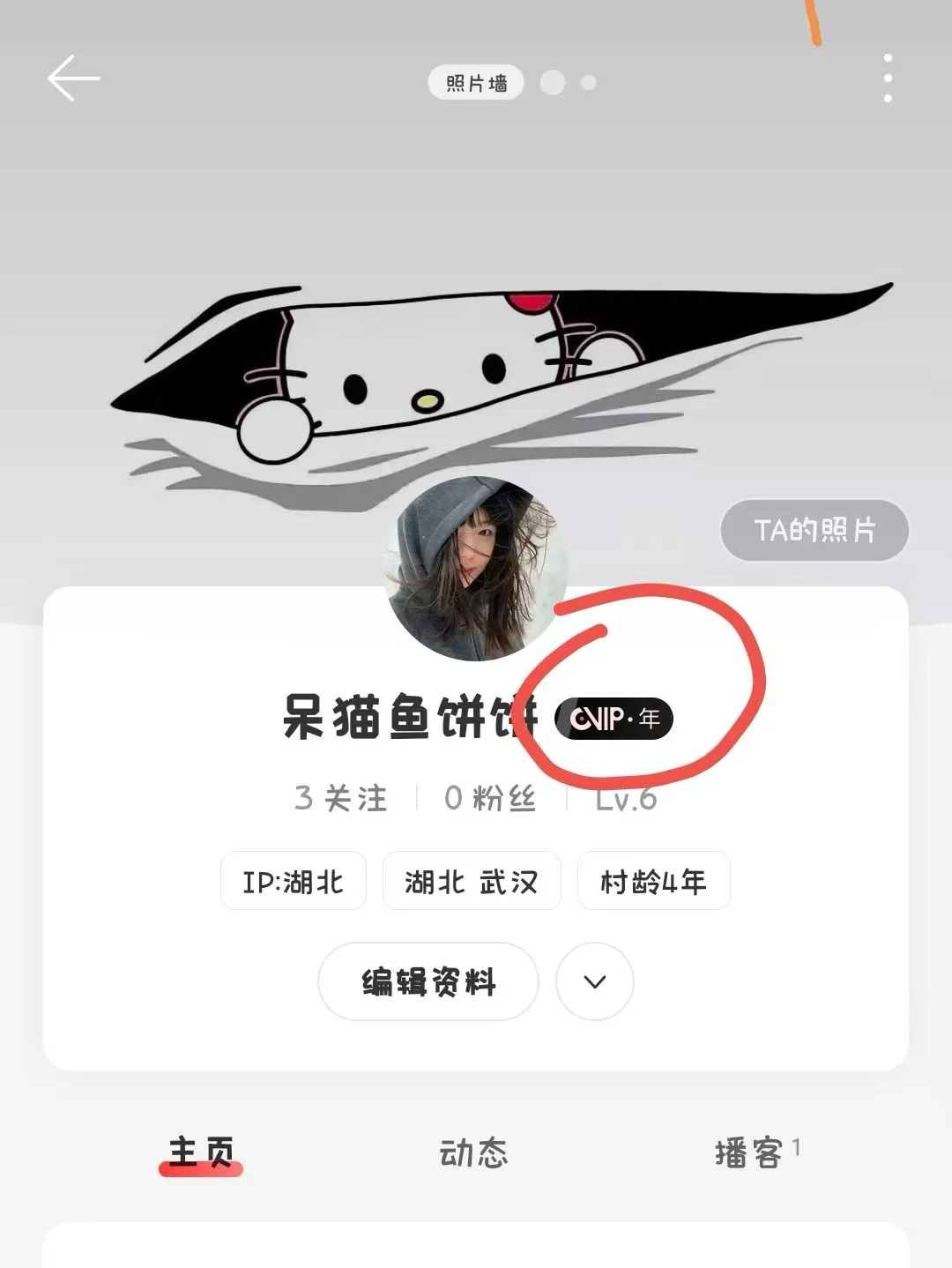 不会还有人没有网易云永久黑胶会员吧！