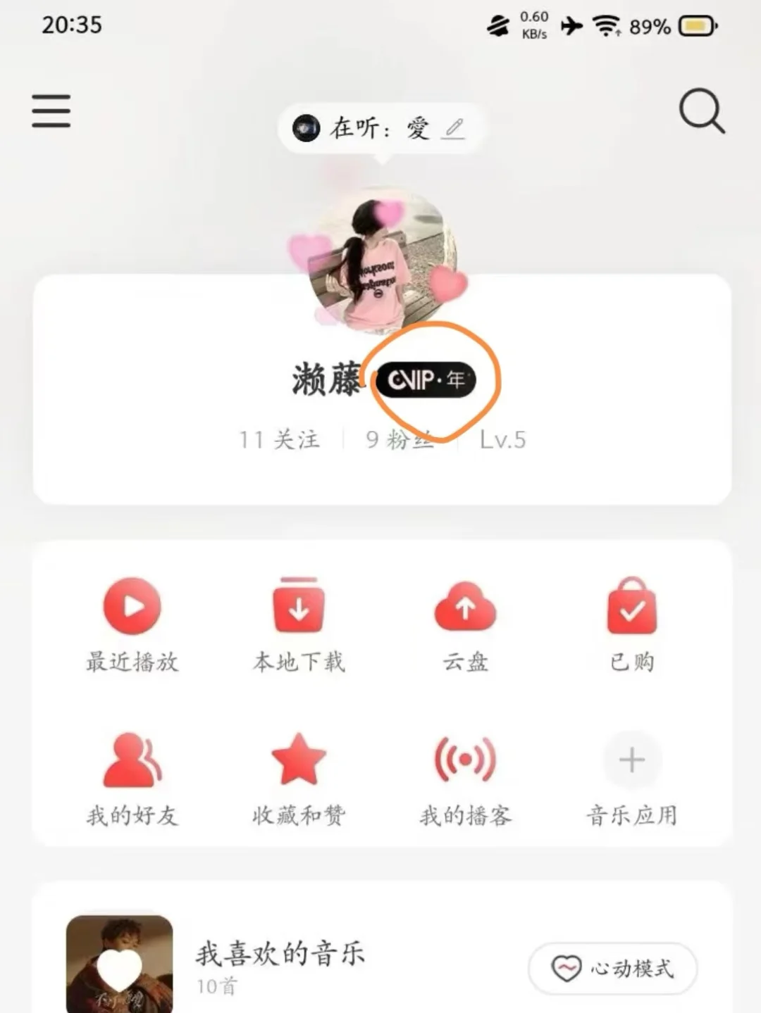 不会还有人没有网易云永久黑胶会员吧！