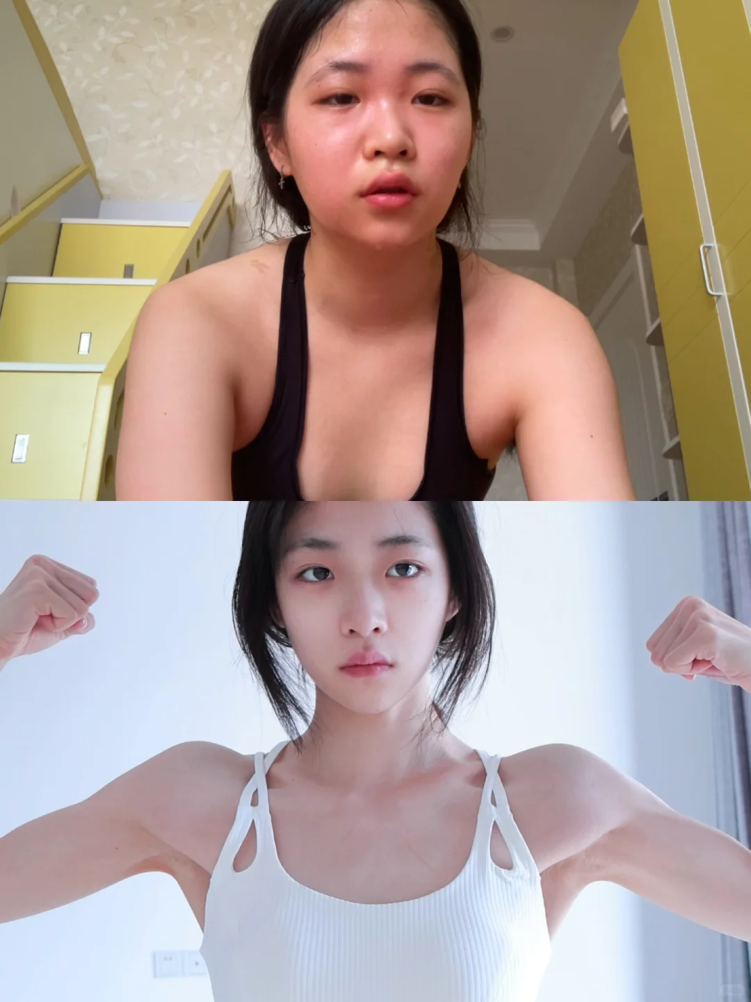 假阔面肉脸变窄小脸的变美思路分享(*≧ω≦)