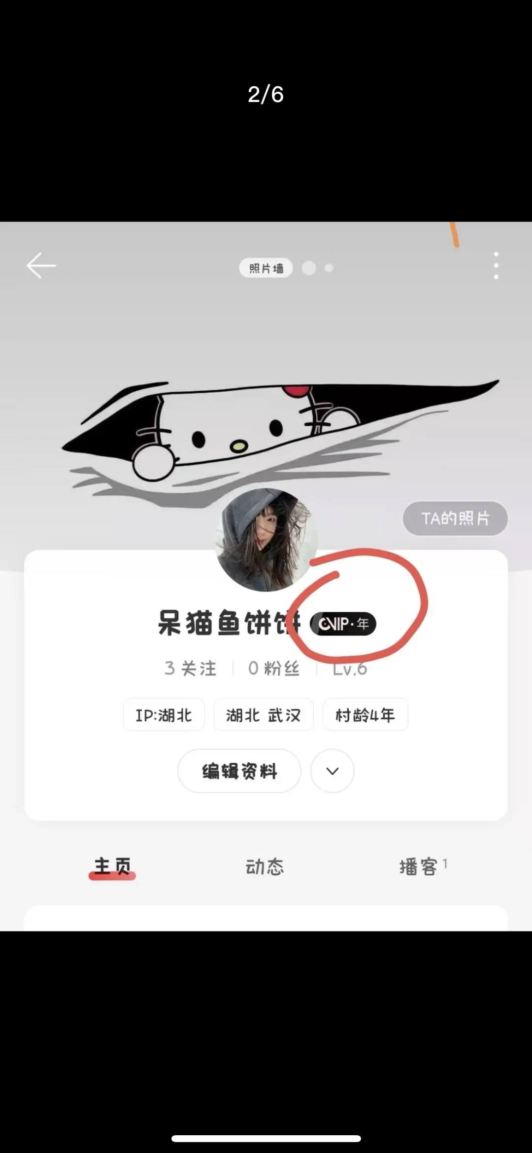 是谁居然还没有网易云黑胶？