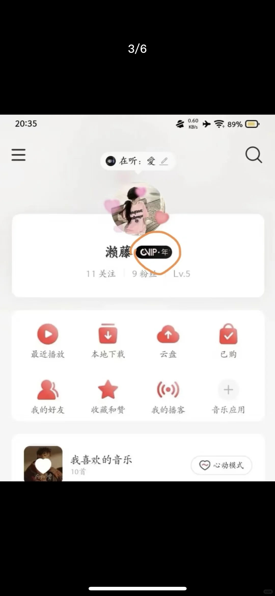 是谁居然还没有网易云黑胶？