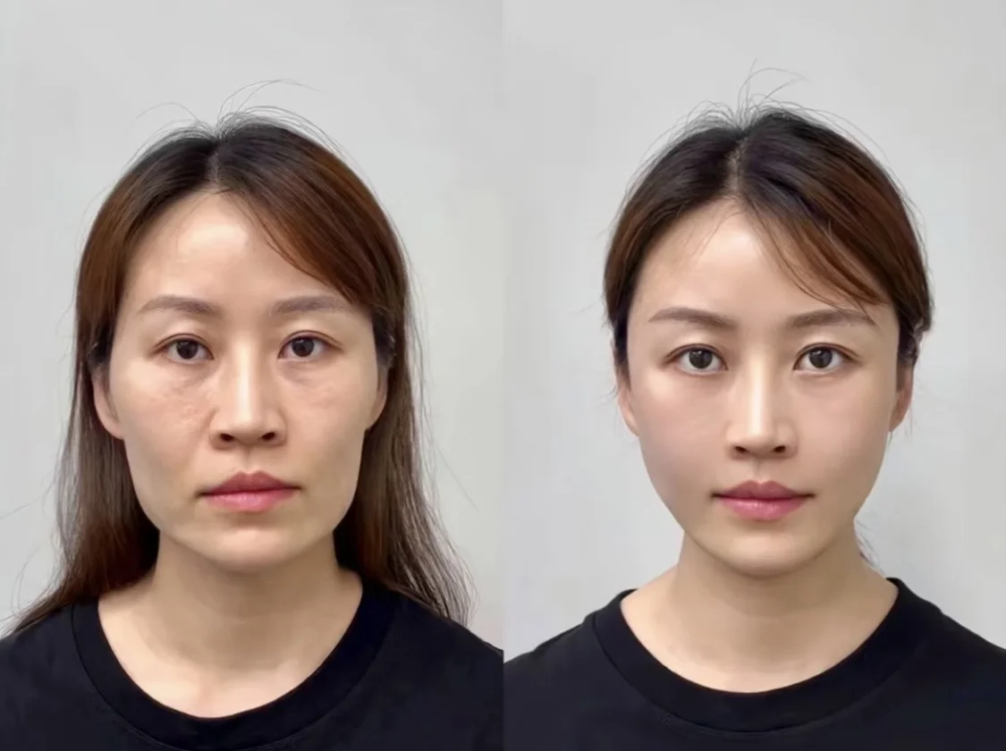 原相机｜原来30+疲态脸微do就可以改善