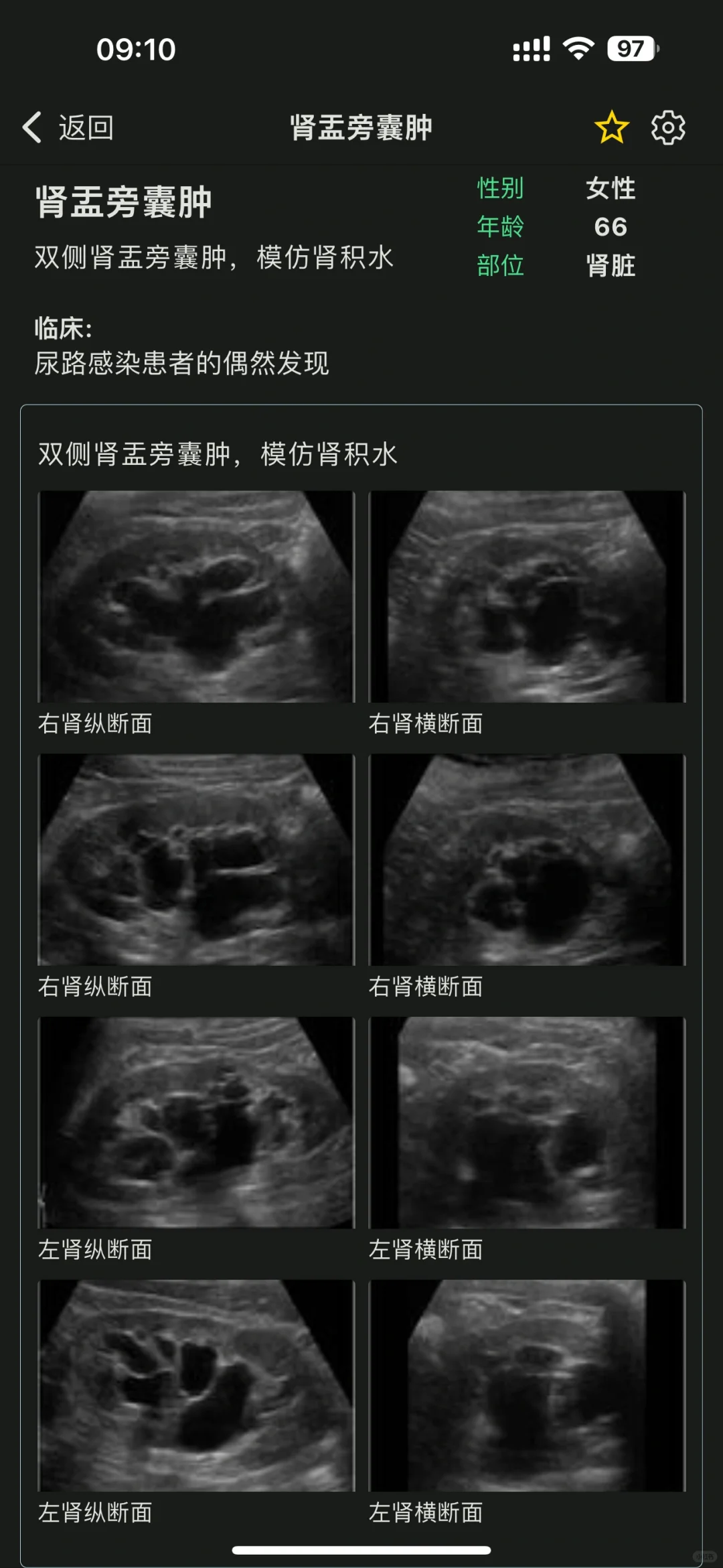 超声医生的智慧囊，🦠超声疾病库YYDS