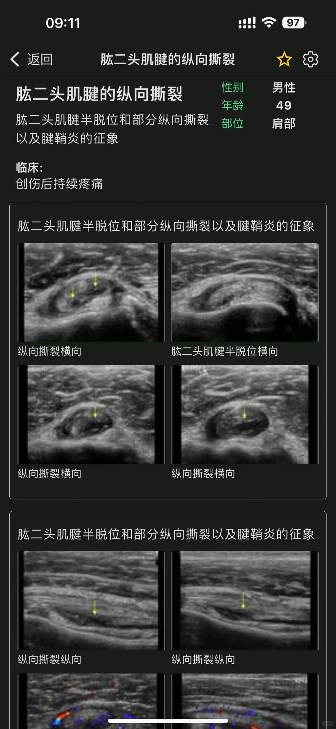 超声医生的智慧囊，🦠超声疾病库YYDS