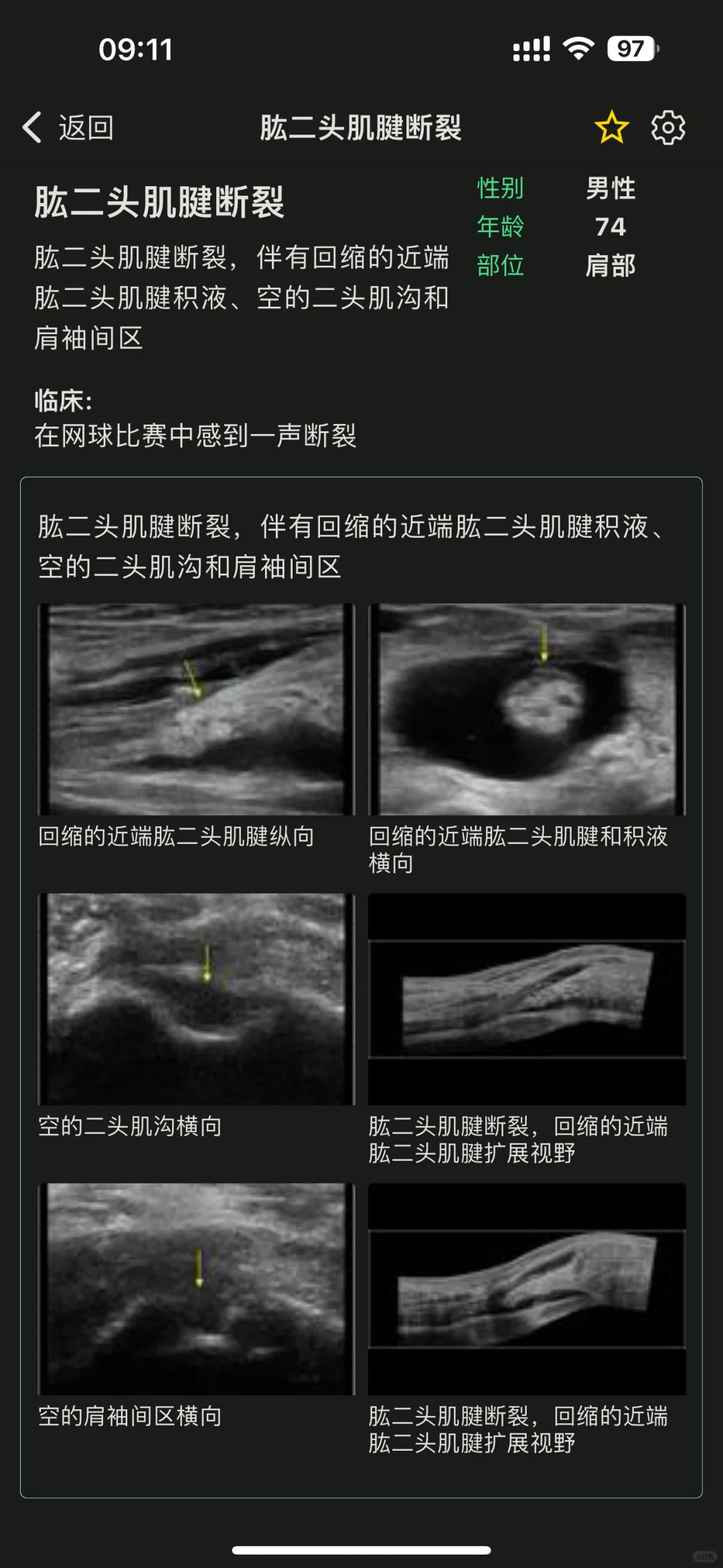 超声医生的智慧囊，🦠超声疾病库YYDS