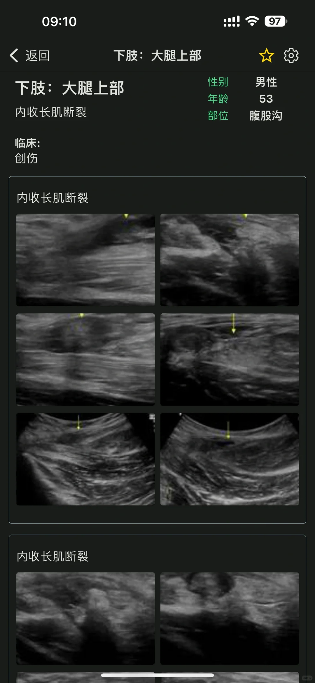 超声医生的智慧囊，🦠超声疾病库YYDS
