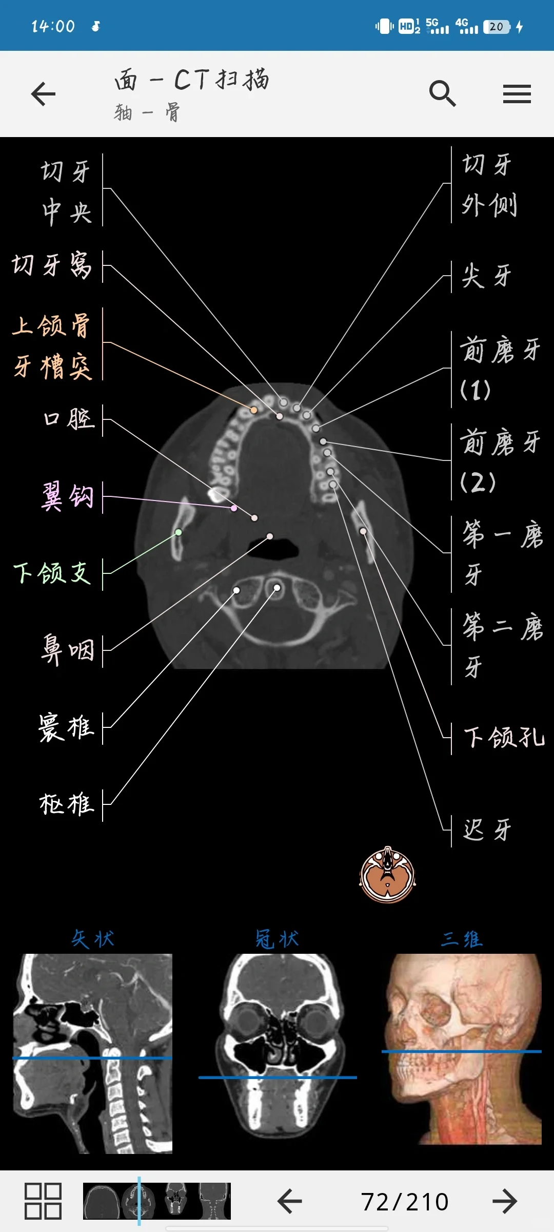 医学影像软件学习 app（安卓）