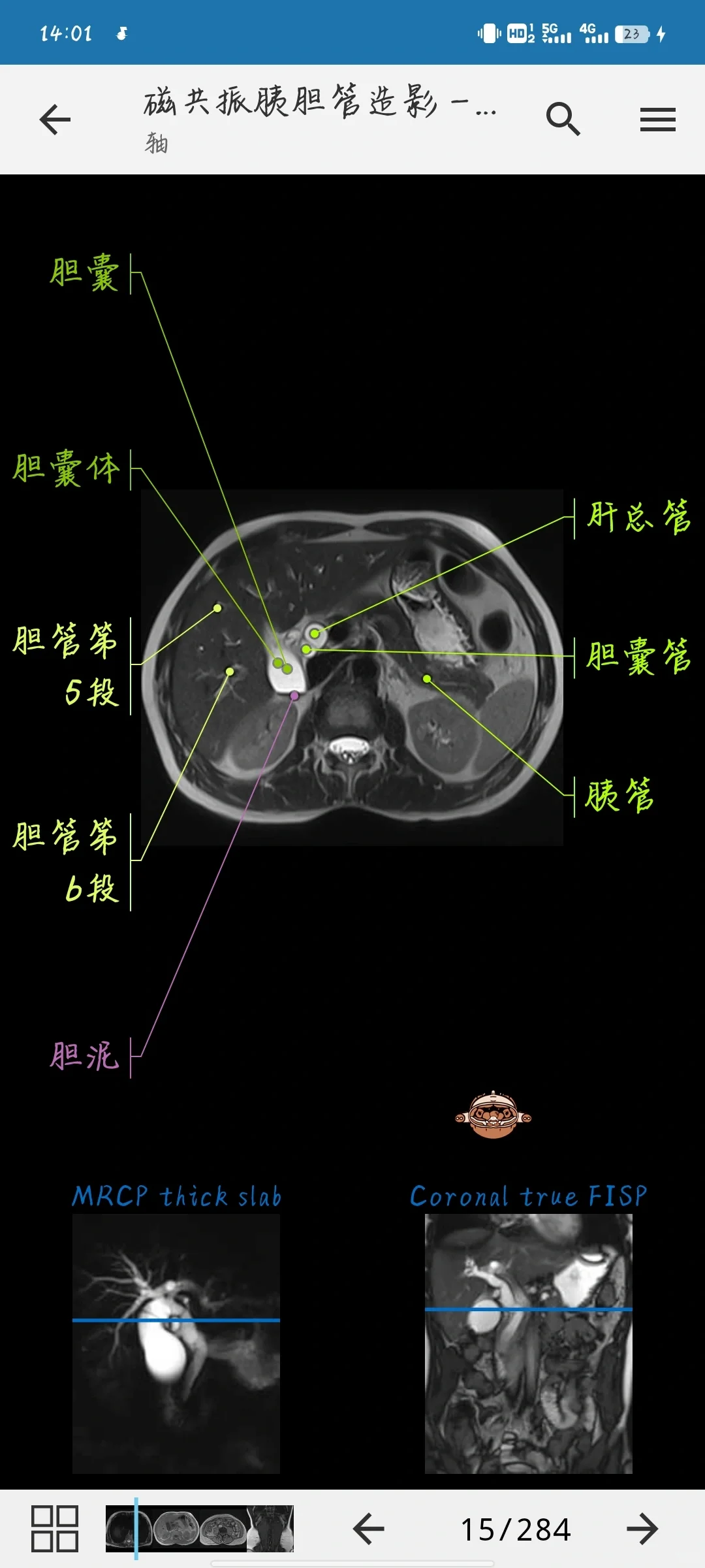医学影像软件学习 app（安卓）
