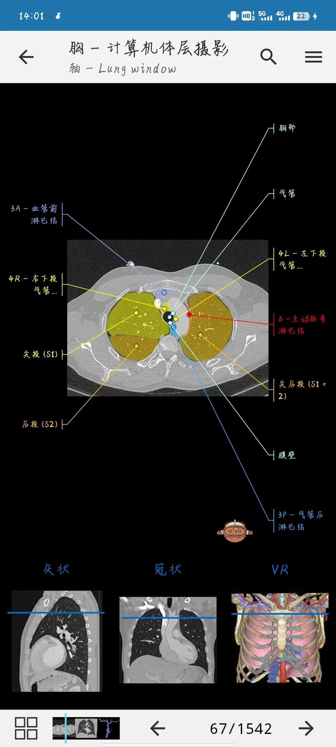 医学影像软件学习 app（安卓）