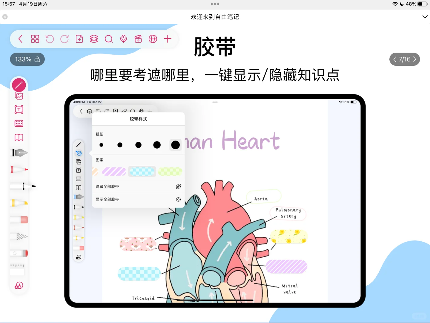 自由笔记还是太听劝了，心巴上的好软件