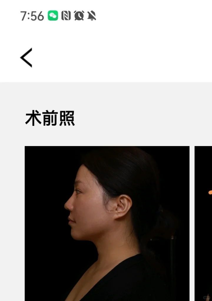 无广，真心觉得新氧的app客户体验满分