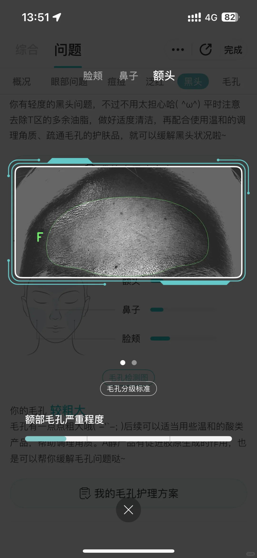 这个测皮肤的app有点东西