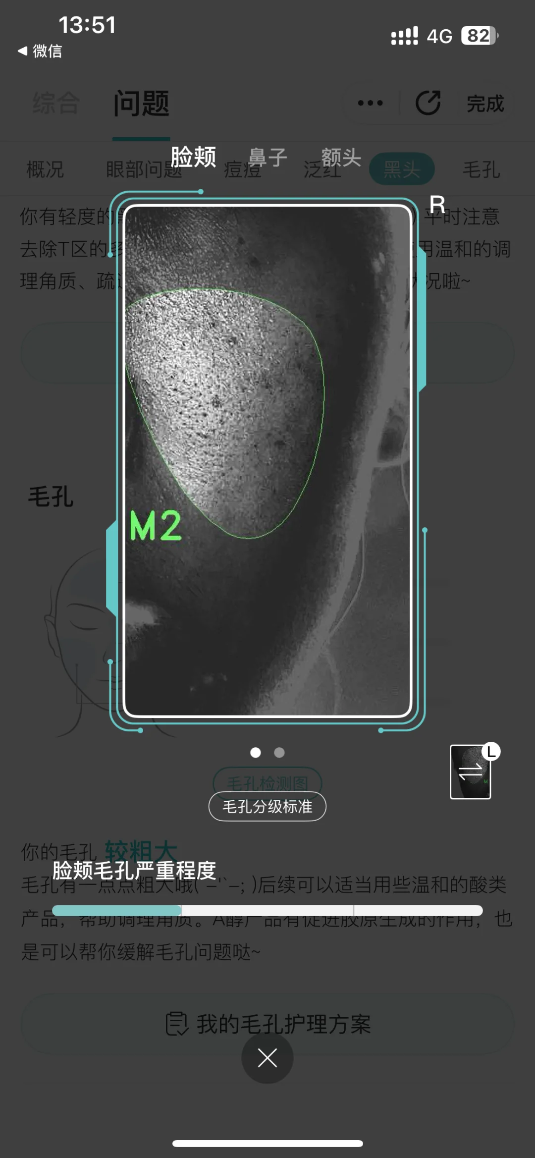 这个测皮肤的app有点东西