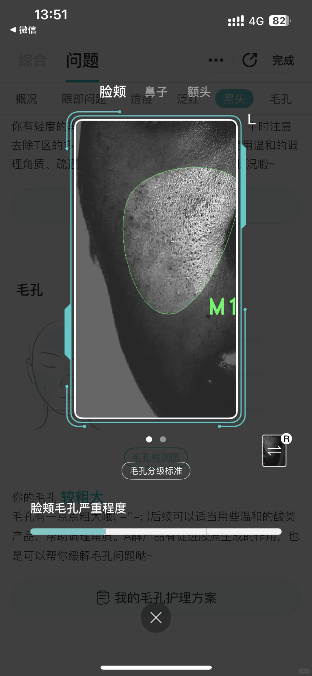 这个测皮肤的app有点东西