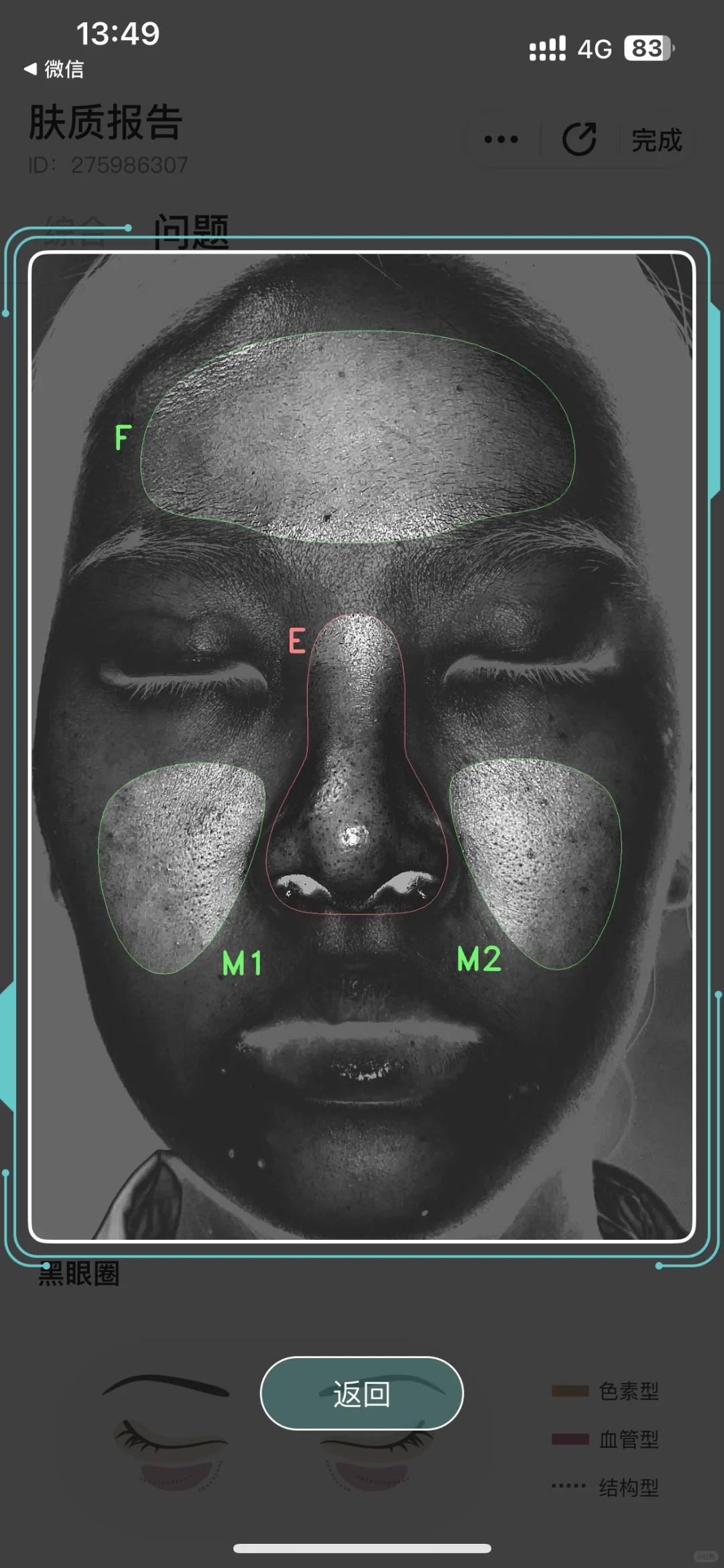 这个测皮肤的app有点东西