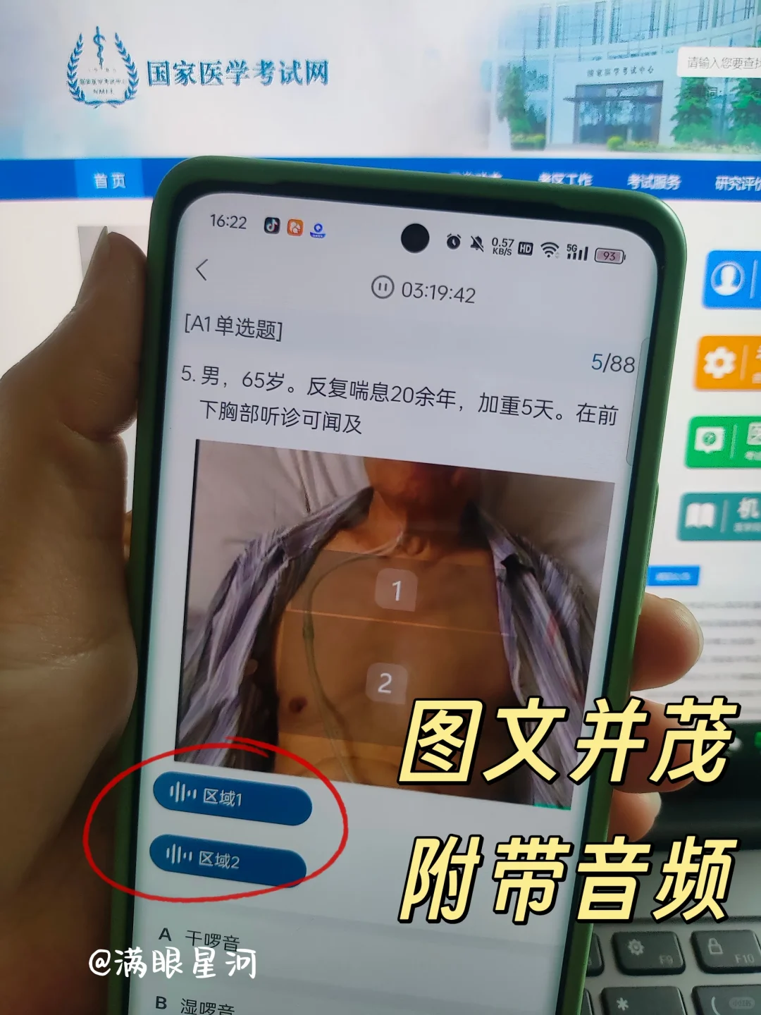 6.14临床技能直接锁死这个app，赢麻啦✌