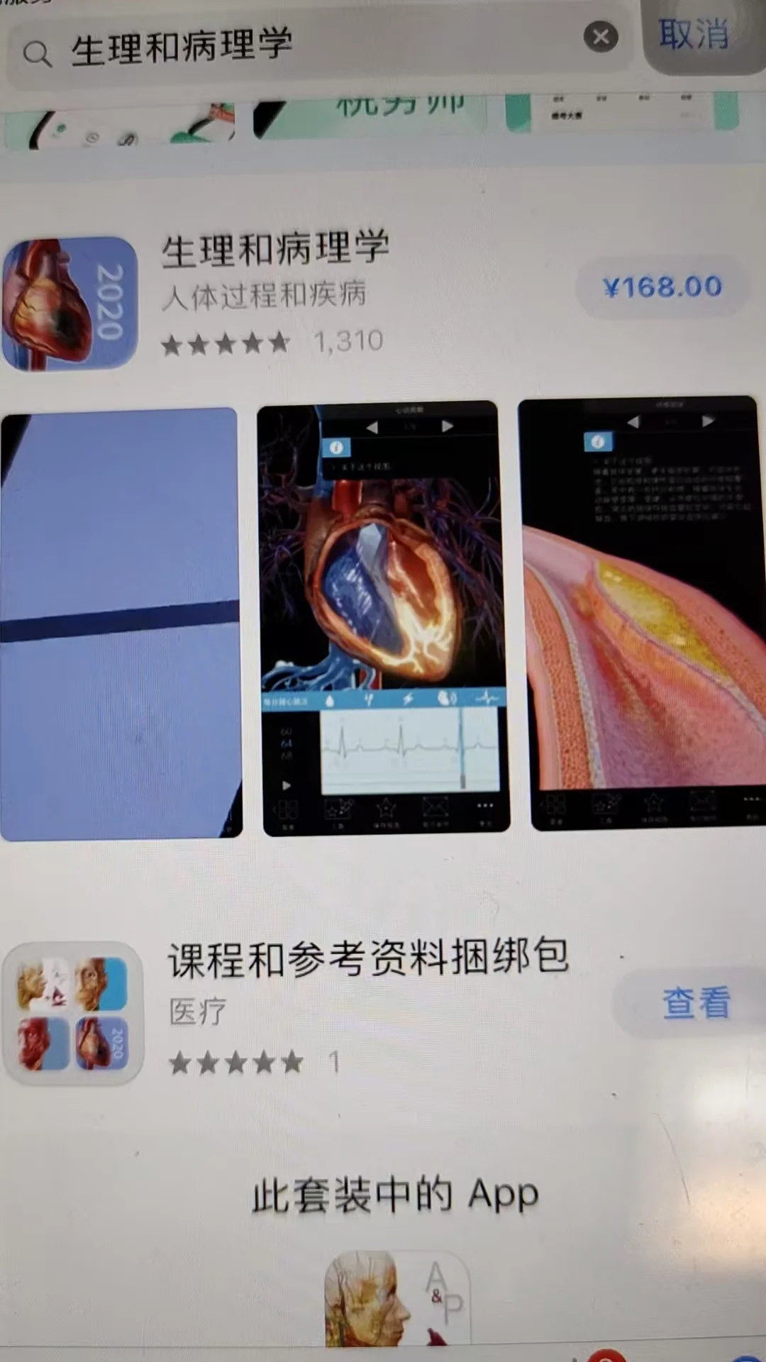 🎉临床必备解剖软件大降价！只要 8块💰