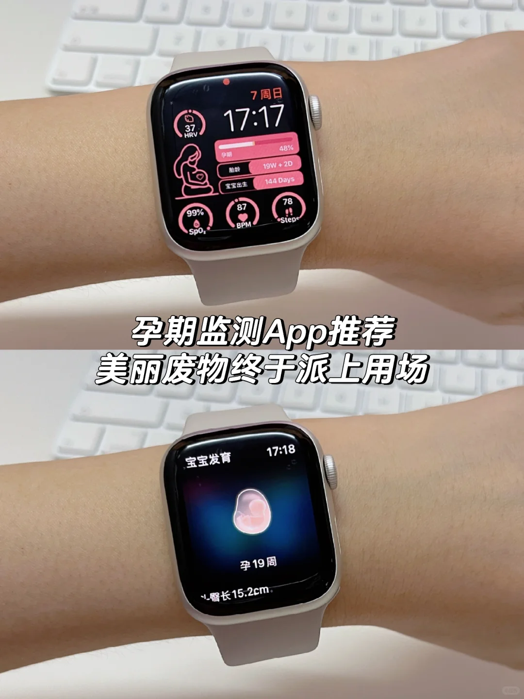 ⌚️孕期监测APP推荐｜美丽废物终于派上用场