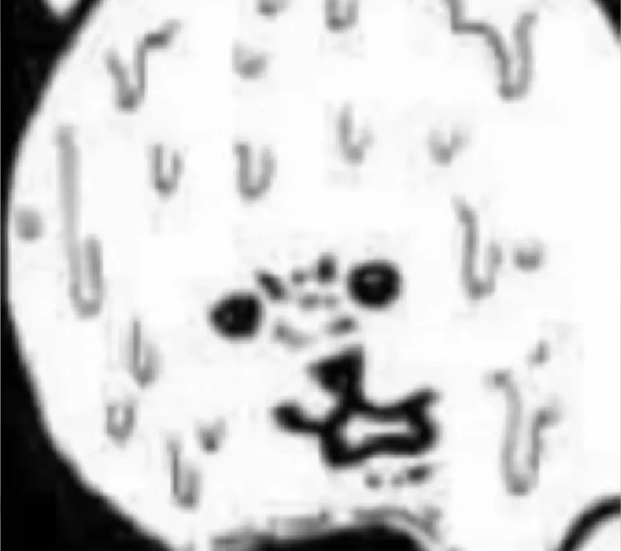 为什么死鸟下载起来这么慢