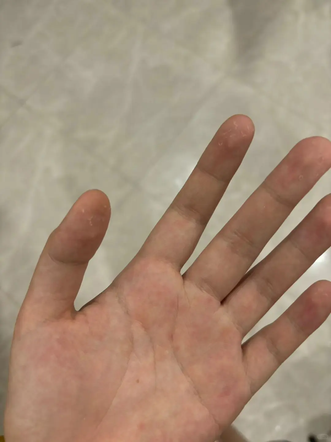 进厂千万不要做插件！