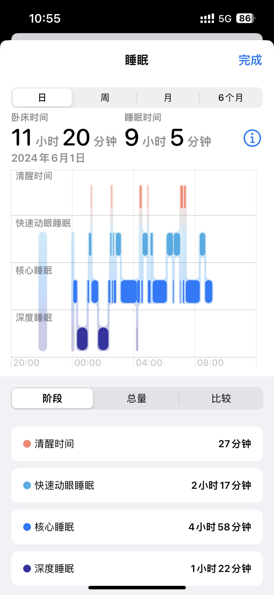 苹果自带睡眠和付费软件记录睡眠千差万别