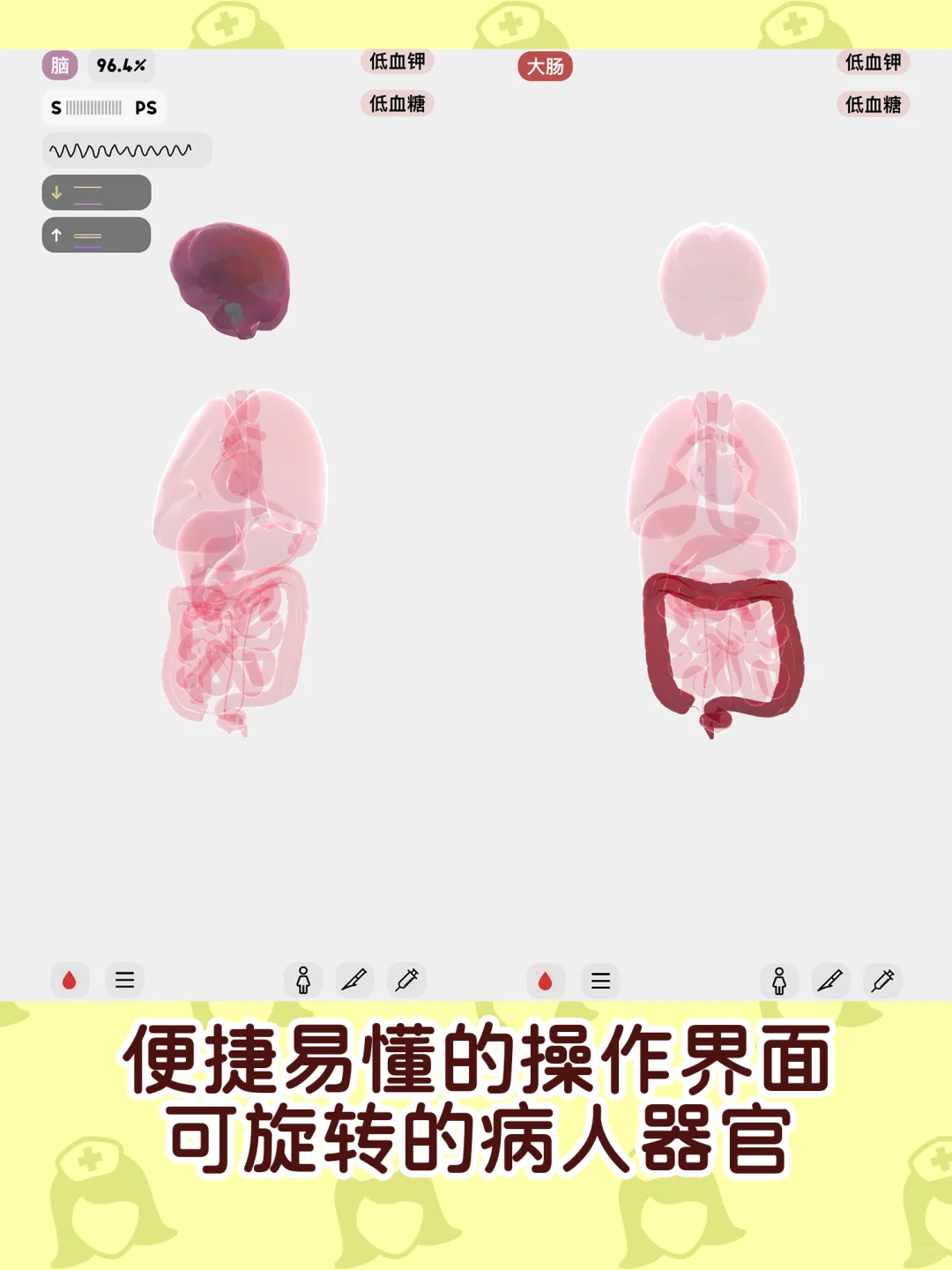 天塌了❗小白误入ICU😱病人心脏骤停❗