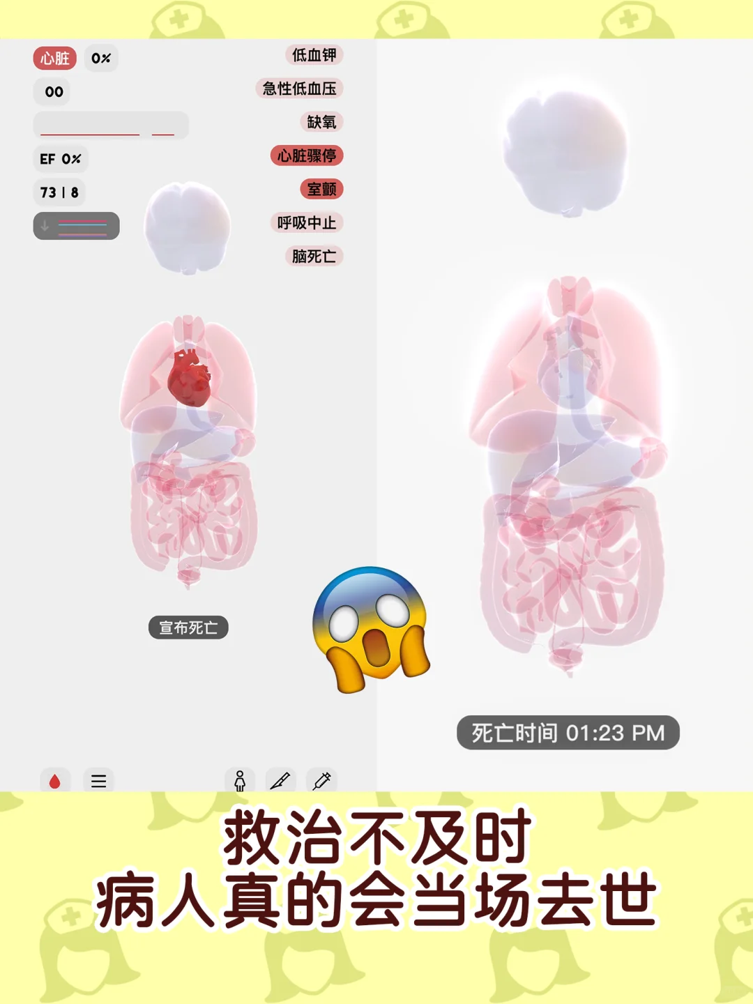 天塌了❗小白误入ICU😱病人心脏骤停❗