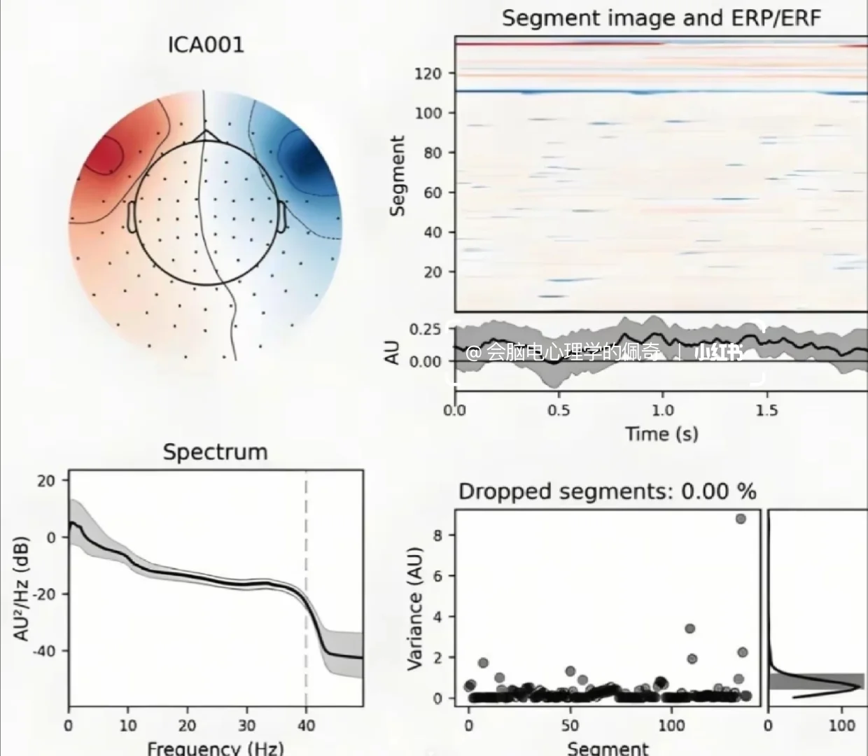 学脑电心理学需要用到什么软件工具