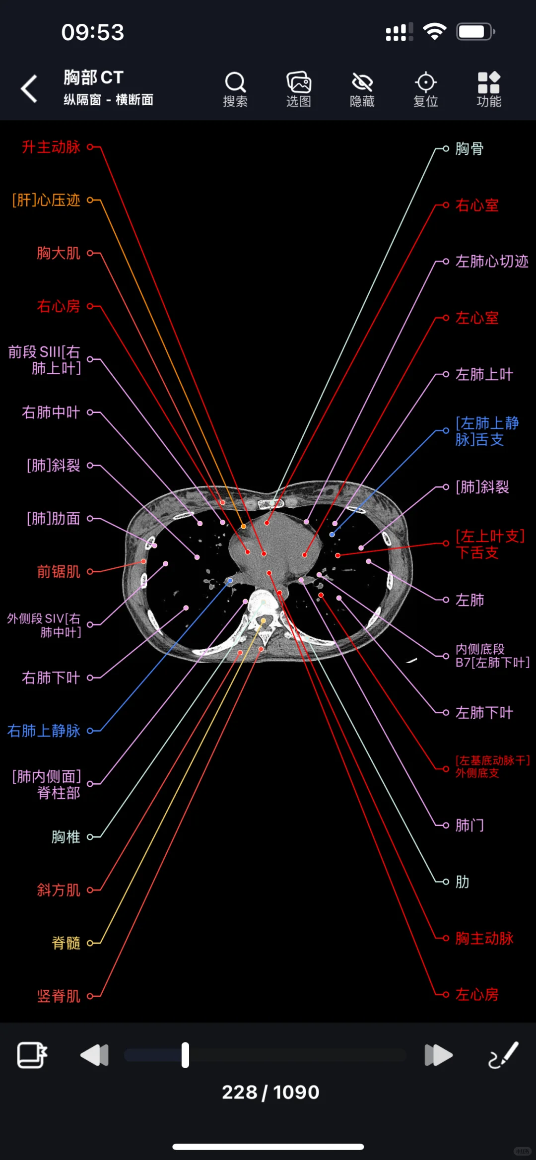 影像解剖图谱app拼单（ios可用）