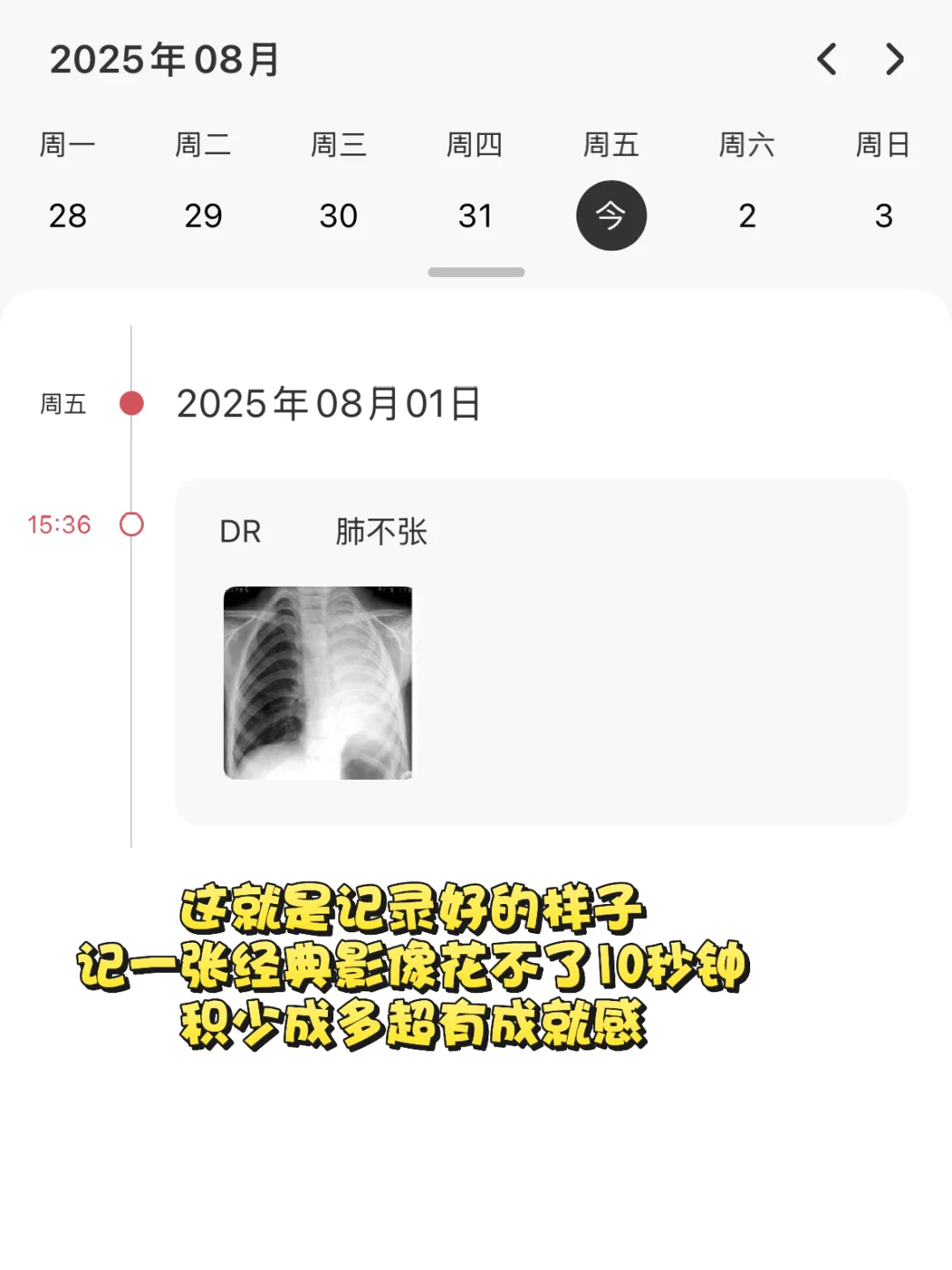 规培生私藏：一个APP搞定碎片化知识📝