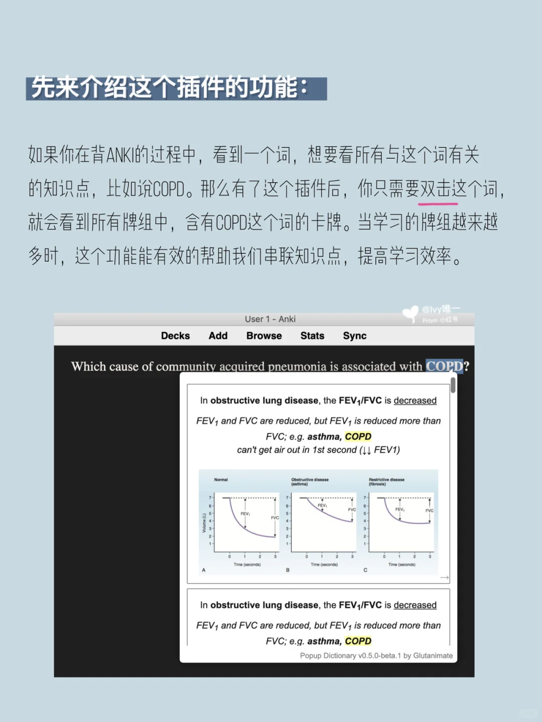 医学生｜提高学习效率的Anki插件1️⃣
