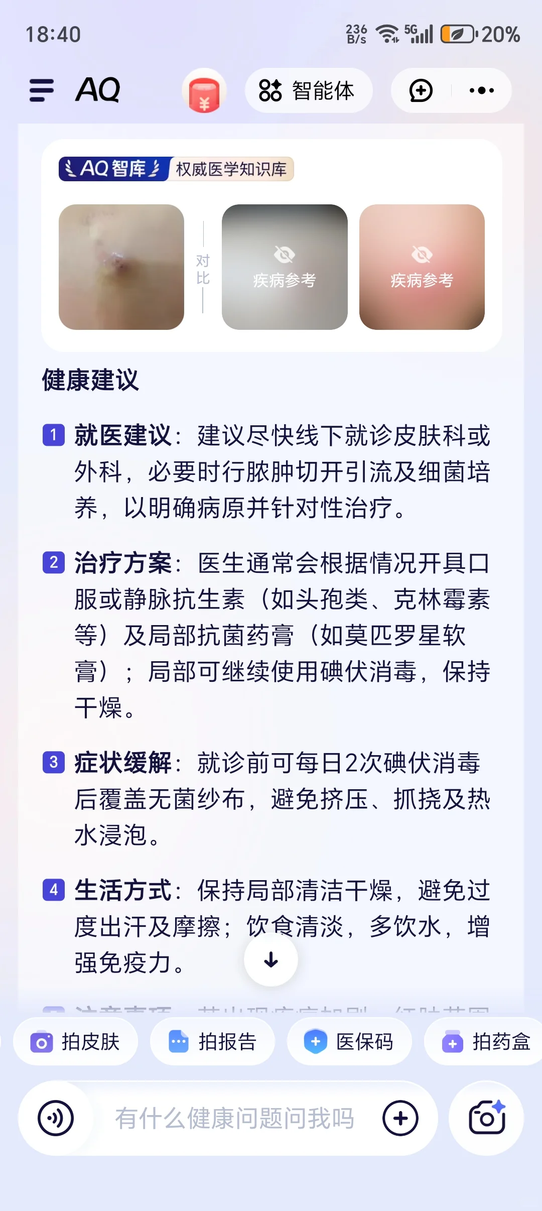 皮脂腺囊肿拍照让AQ问诊结果还不错！
