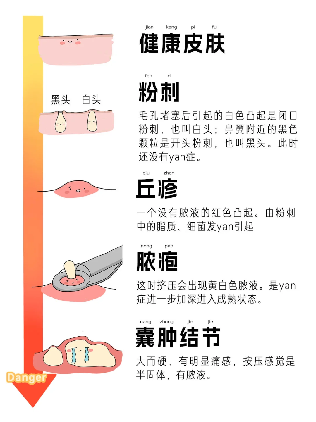 皮肤祛痘问题最怕弄不清类型👉AQ帮你秒识别