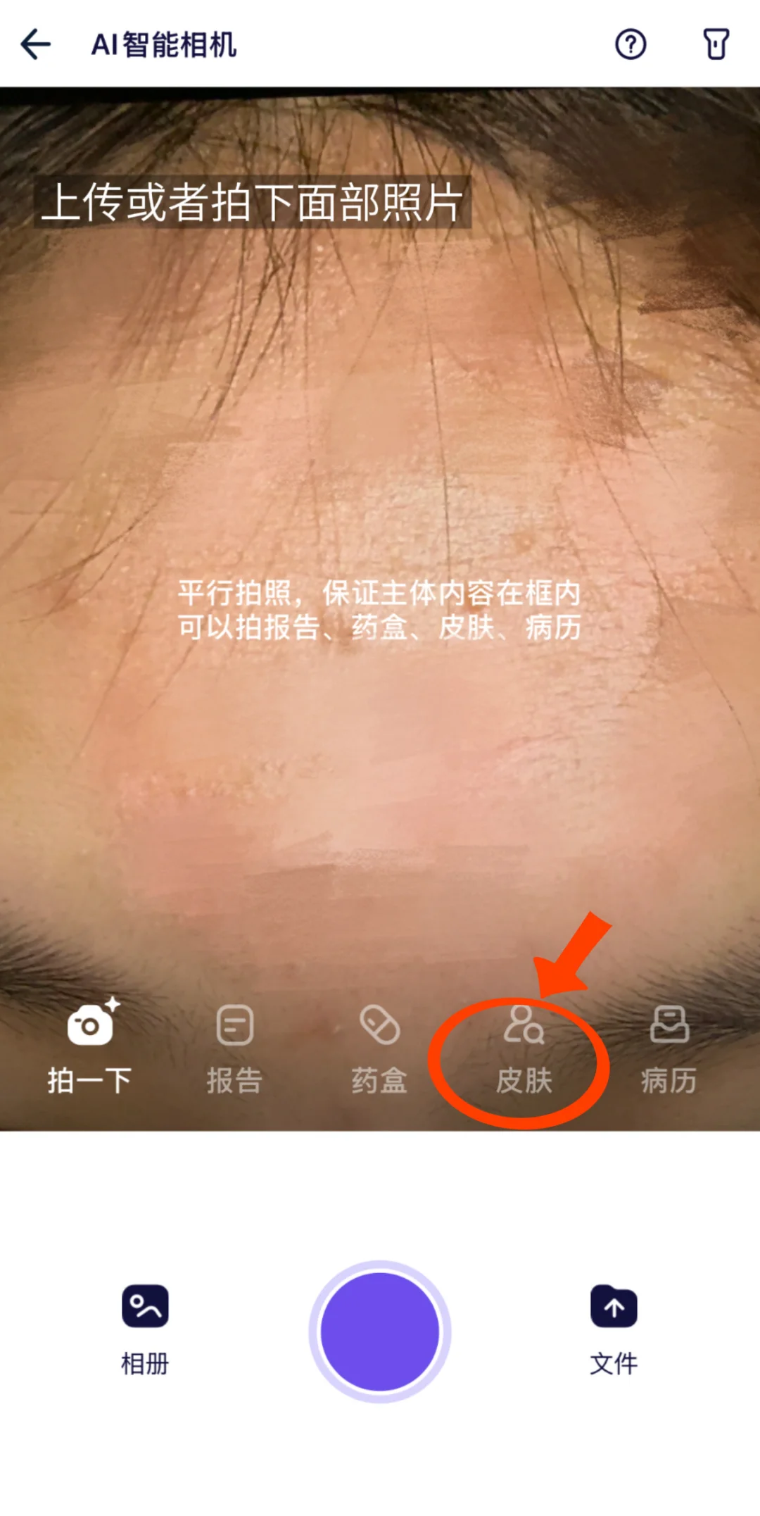 皮肤祛痘问题最怕弄不清类型👉AQ帮你秒识别