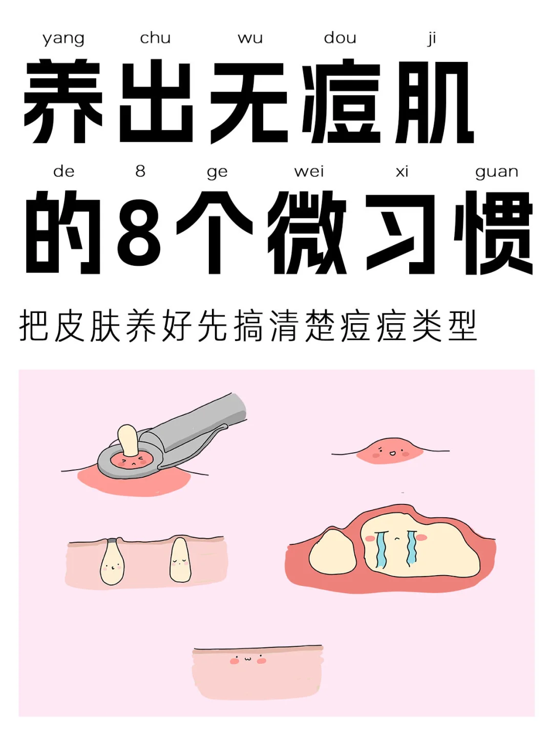 皮肤祛痘问题最怕弄不清类型👉AQ帮你秒识别