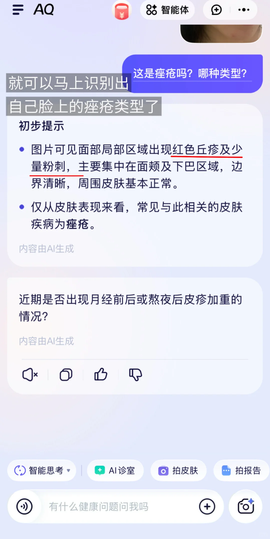 皮肤祛痘问题最怕弄不清类型👉AQ帮你秒识别