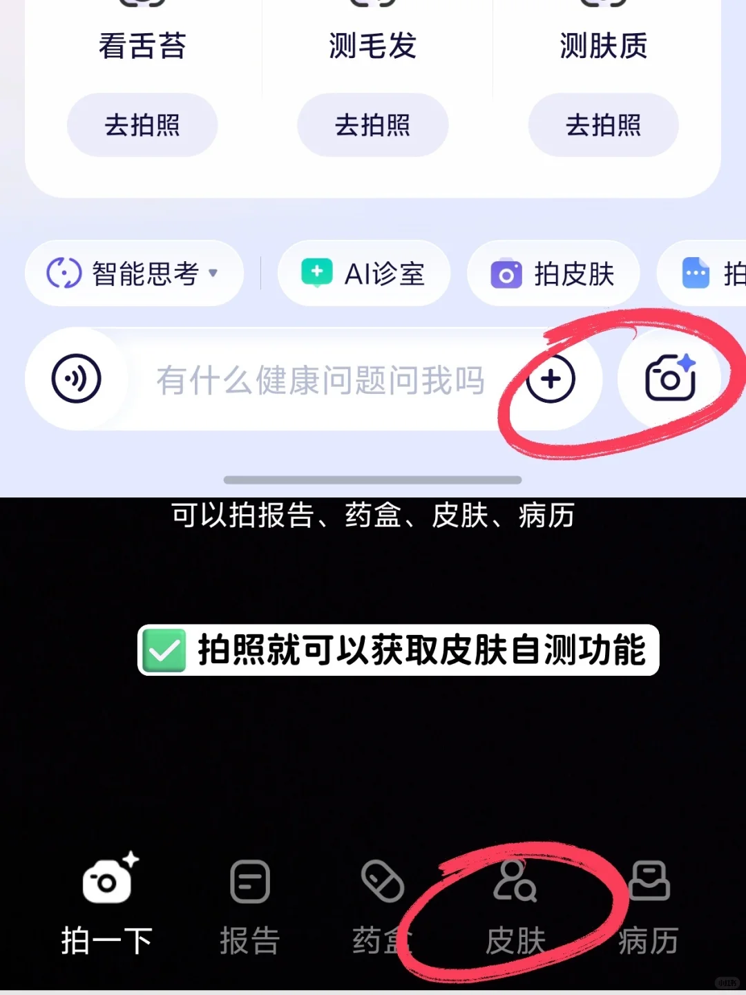 青春期战痘不迷茫：从辨痘到护心，一招全搞定