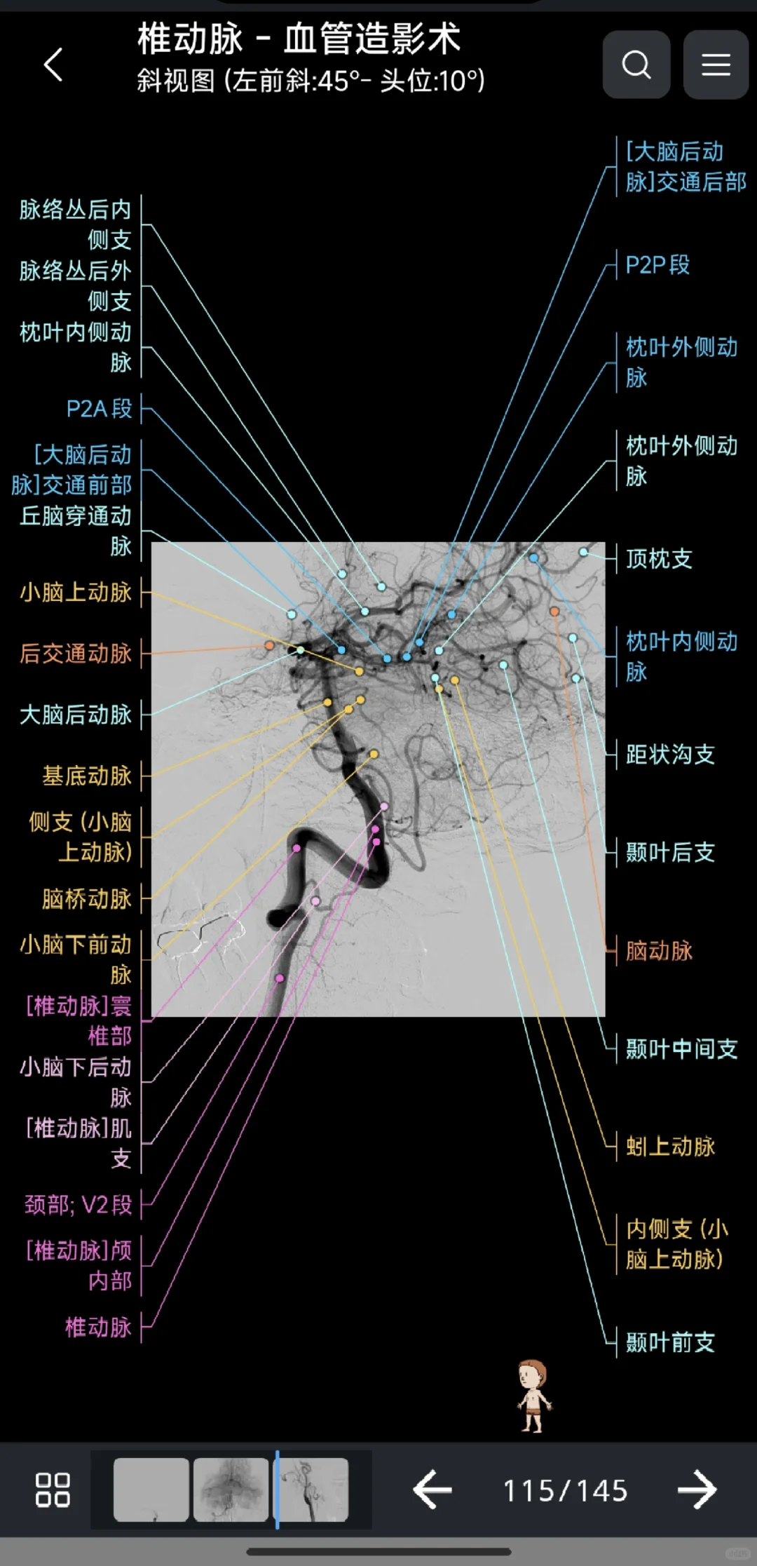 永久使用的医学影像解剖图谱 e anatomy