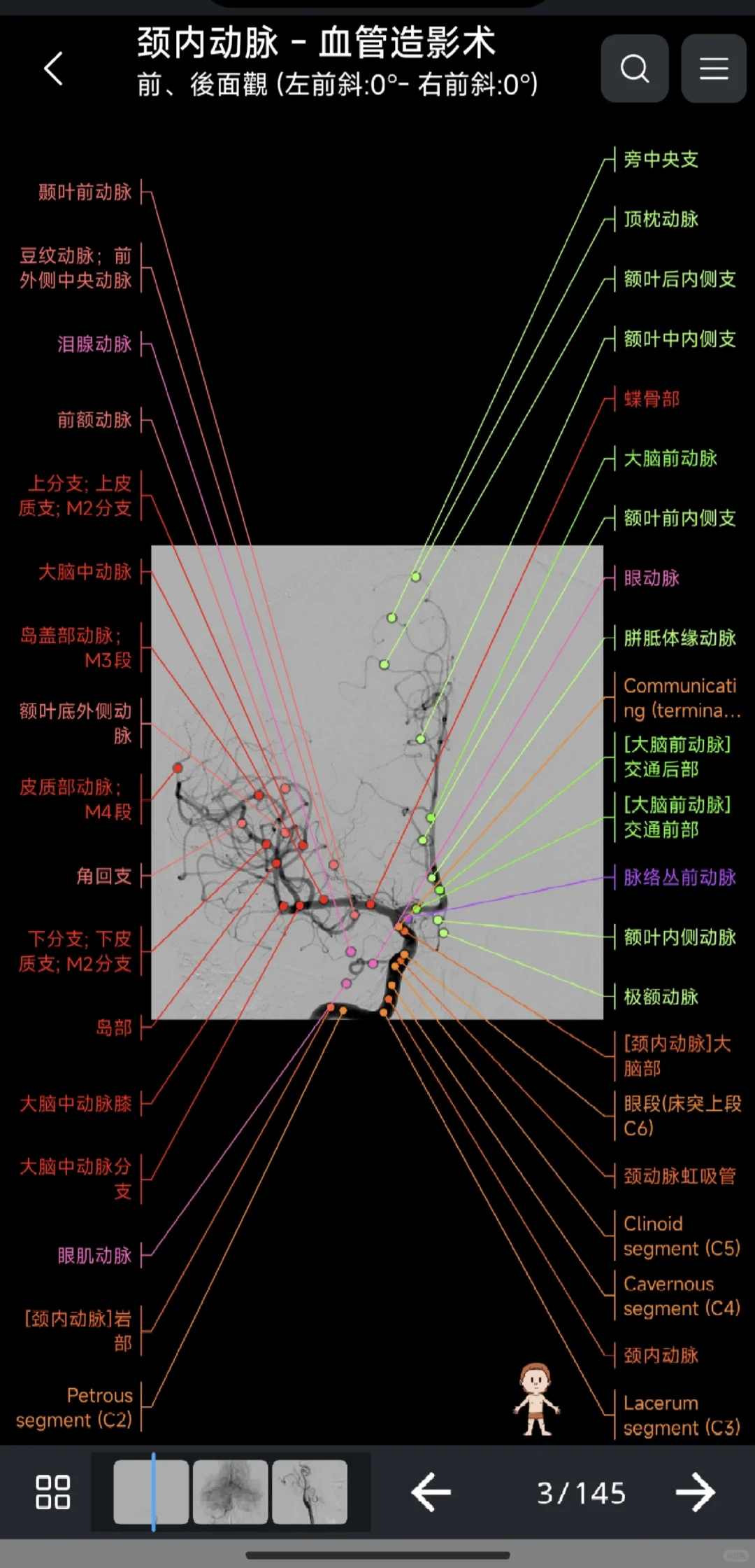 永久使用的医学影像解剖图谱 e anatomy