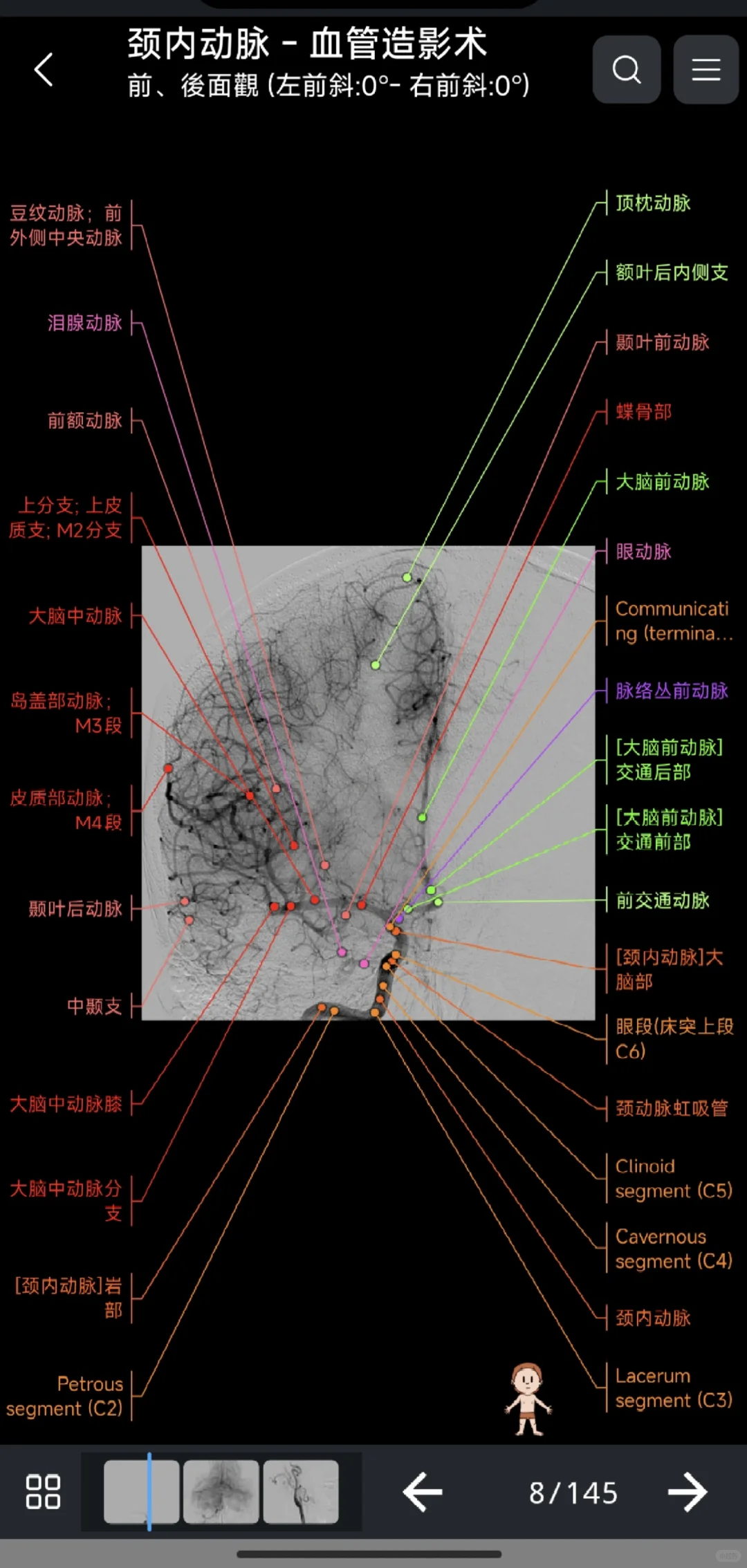 永久使用的医学影像解剖图谱 e anatomy